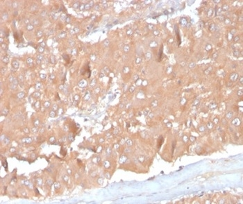 Monocyte Chemotactic Protein 2 (MCP2) / CCL8 Antibody