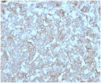 Monocyte Chemotactic Protein 2 (MCP2) / CCL8 Antibody