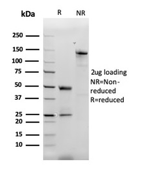 Monocyte Chemotactic Protein 2 (MCP2) / CCL8 Antibody