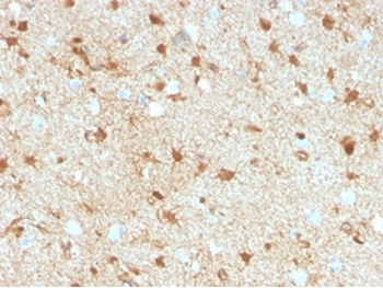 S100B (Astrocyte and Melanoma Marker) Antibody