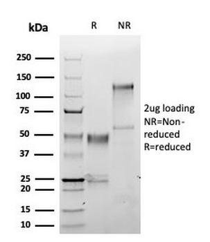 S100A1 Antibody