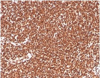 Replication Protein A2 (RPA2) Antibody