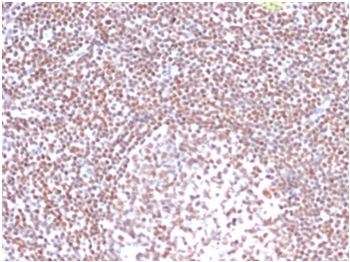 Replication Protein A2 (RPA2) Antibody