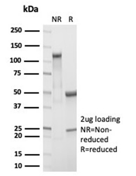 Recombinant RBP4 / Retinol Binding Protein 4 Antibody