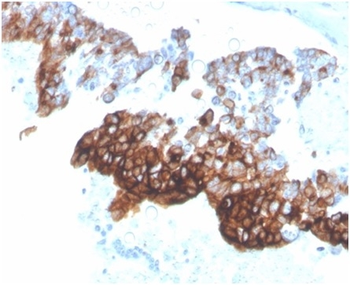 Recombinant Cytokeratin 7 (Glandular and Transitional Epithelial Marker) Antibody