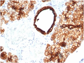 Recombinant Cytokeratin 7 (Glandular and Transitional Epithelial Marker) Antibody