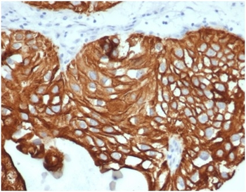 Recombinant Cytokeratin 7 (Glandular and Transitional Epithelial Marker) Antibody