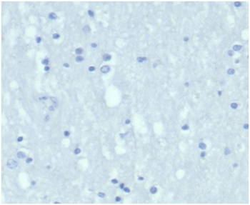 Recombinant Cytokeratin 7 (Glandular and Transitional Epithelial Marker) Antibody
