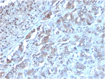 Interleukin-2 (IL-2) Antibody