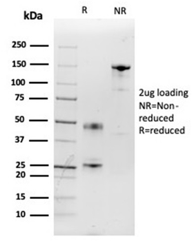 Interleukin-2 (IL-2) Antibody
