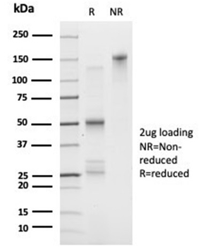 FOXL1 / Forkhead Box Protein L1 (Transcription Factor) Antibody