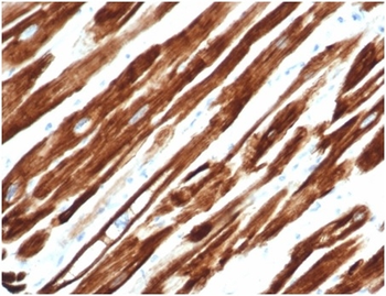 DES Antibody