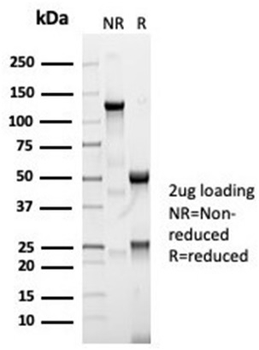 Recombinant Angiotensin I Converting Enzyme (ACE) / CD143 Antibody