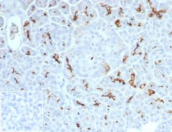 Recombinant CFTR (Cystic Fibrosis Transmembrane Conductance Regulator) Antibody