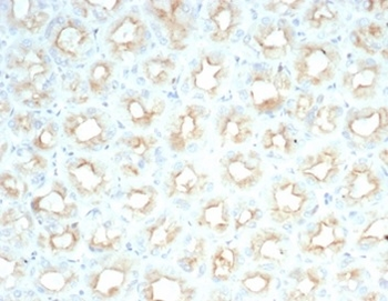 Recombinant CFTR (Cystic Fibrosis Transmembrane Conductance Regulator) Antibody