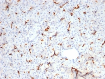 Recombinant CFTR (Cystic Fibrosis Transmembrane Conductance Regulator) Antibody