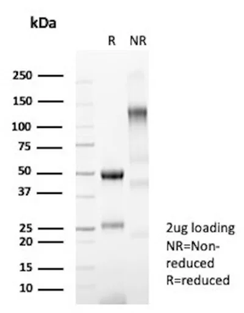 Recombinant CFTR (Cystic Fibrosis Transmembrane Conductance Regulator) Antibody