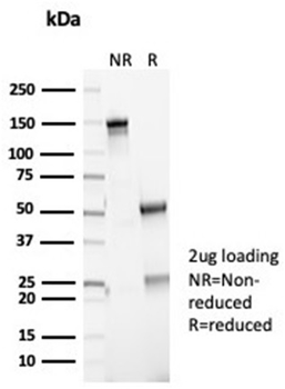 Recombinant P16INK4a Antibody