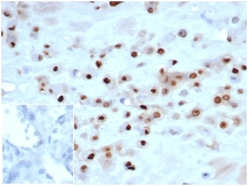 CDKN1C Antibody