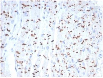 Recombinant N-Cadherin / Cadherin-2 / CD325 (NCAD) Antibody