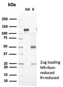 Recombinant N-Cadherin / Cadherin-2 / CD325 (NCAD) Antibody