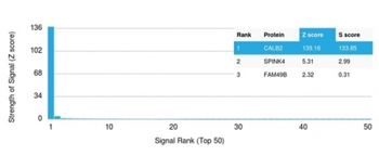Recombinant Calretinin / Calbindin 2 (Mesothelioma Marker) Antibody
