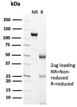Recombinant Calretinin / Calbindin 2 (Mesothelioma Marker) Antibody