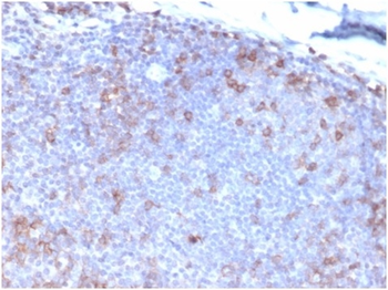 FASLG Antibody