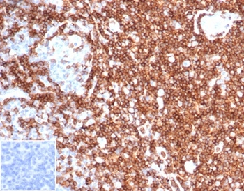 Recombinant CD43 (T-Cell Marker) Antibody