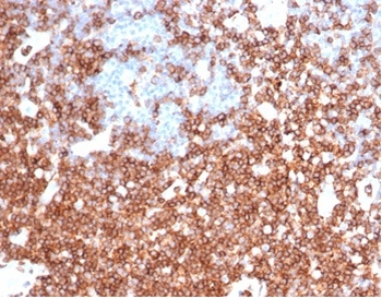Recombinant CD43 (T-Cell Marker) Antibody