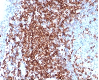 Recombinant CD43 (T-Cell Marker) Antibody