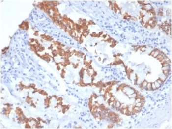 KRT8 Antibody