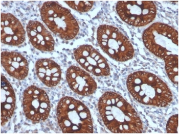 KRT8 Antibody