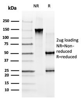 GLIS family zinc finger 3 (GLIS3) / ZNF515 Antibody