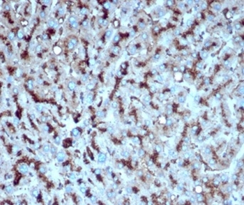 Cathepsin D (Tumor Marker) Antibody