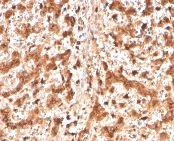 Cathepsin D (Tumor Marker) Antibody