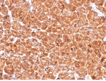 Cathepsin D (Tumor Marker) Antibody