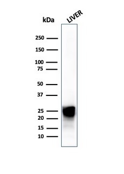 Cathepsin D (Tumor Marker) Antibody