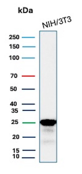 Recombinant p27Kip1 (Mitotic Inhibitor/Suppressor Protein) Antibody