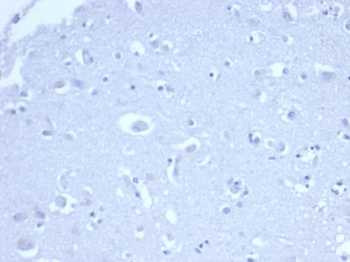 CDKN1A Antibody