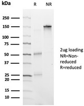 HDAC6 Antibody