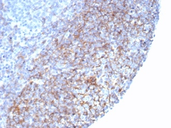 Recombinant CD35 / CR1 (Follicular Dendritic Cell Marker) Antibody