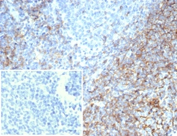 Recombinant CD35 / CR1 (Follicular Dendritic Cell Marker) Antibody