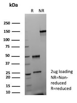 Recombinant CD35 / CR1 (Follicular Dendritic Cell Marker) Antibody