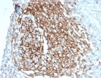 Recombinant CD35 / CR1 (Follicular Dendritic Cell Marker) Antibody