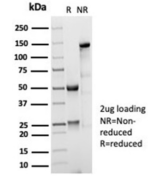 Recombinant CD35 / CR1 (Follicular Dendritic Cell Marker) Antibody