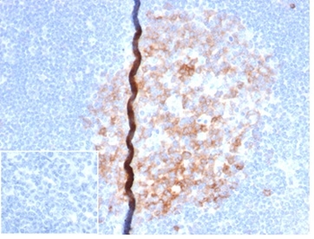 Recombinant CD86 (Dendritic Cells Maturation Marker) Antibody