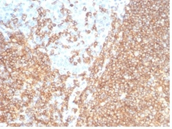 Recombinant CD20 / MS4A1 (B-Cell Marker) Antibody