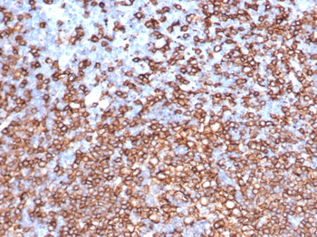 Recombinant CD20 / MS4A1 (B-Cell Marker) Antibody