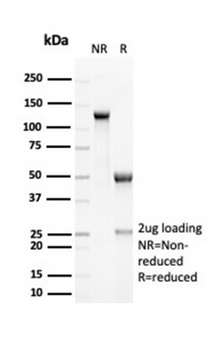 EBAG9 Antibody